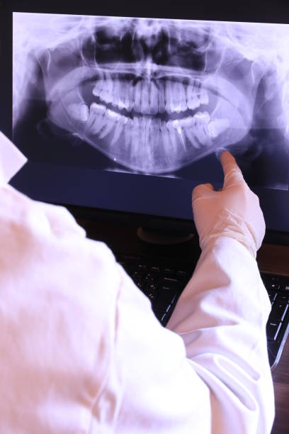 Best Emergency Wisdom Tooth Extraction in Dunkirk, MD
