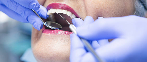 Best Emergency Dental Care for Sports Injuries in Dunkirk, MD